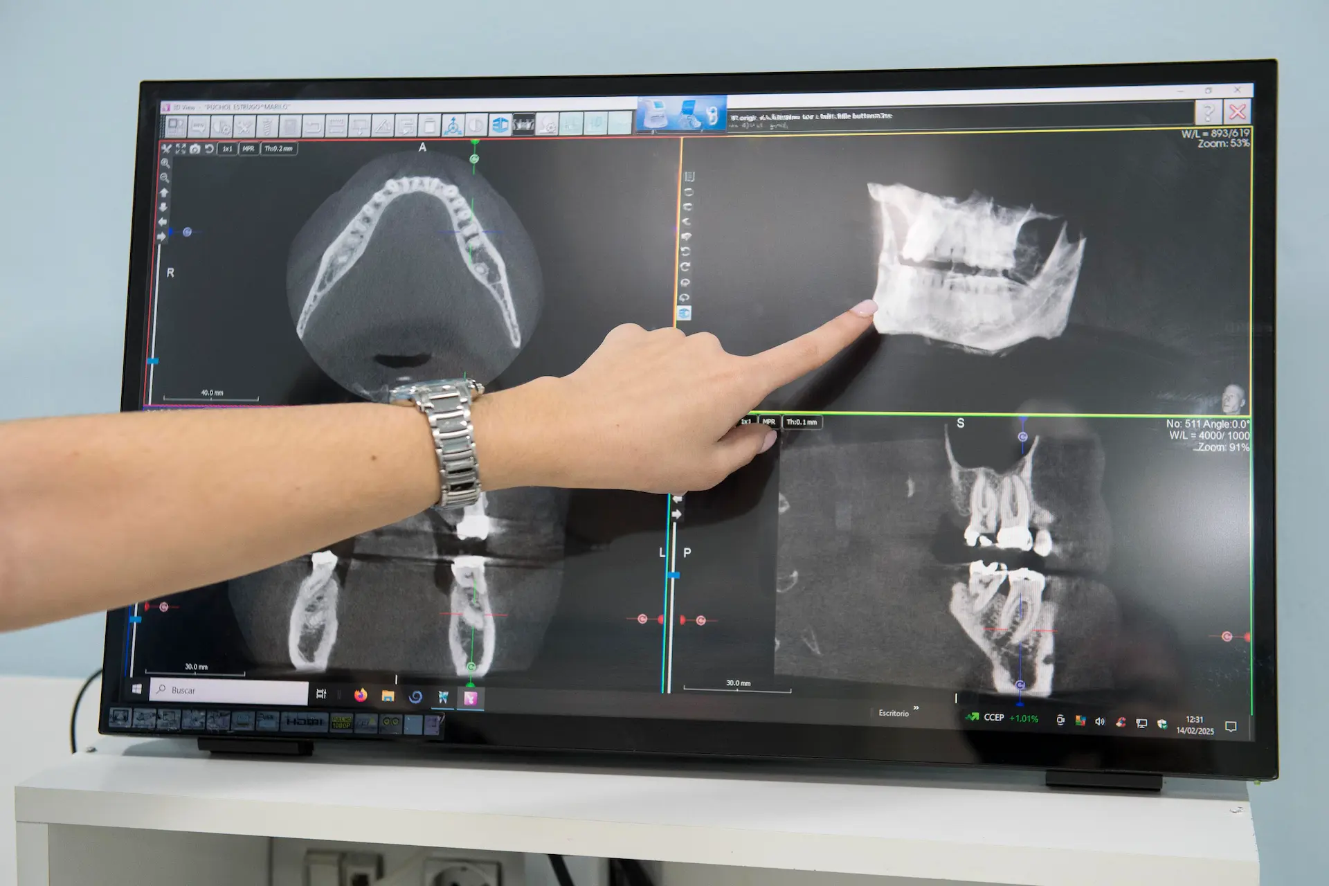 Equipo de tecnologia CBCT en la Clinica Dental Marilo Puchol